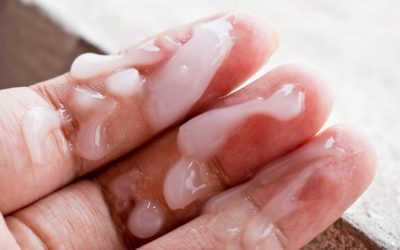 Tinh trùng đặc tốt hay xấu? 5 nguyên nhân tinh trùng đặc cần chú ý