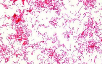 [Cảnh báo…] Nguy hiểm tiềm tàng từ trực khuẩn gram!