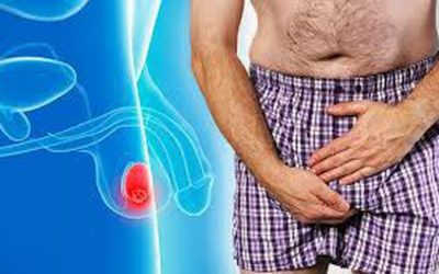 [ Đau tinh hoàn bên phải ] – 85% do bệnh lý nguy hiểm gây ra