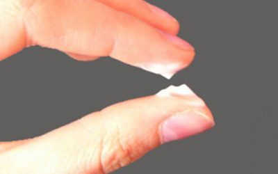 Khí hư như thế nào là bình thường? Cảnh báo dấu hiệu bệnh lý phụ khoa