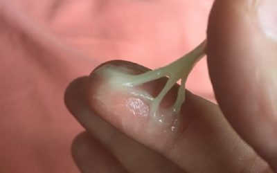 [Danh Sách] – 10 cách chữa khí hư màu xanh tại nhà chị em nên biết