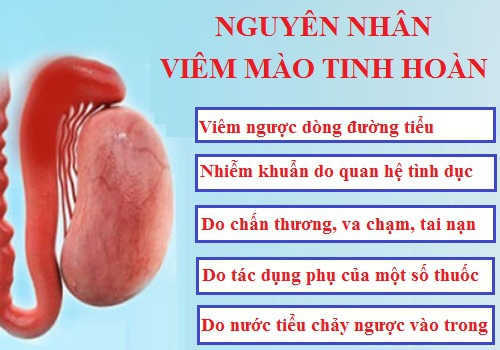 Đi tìm nguyên nhân viêm mào tinh hoàn