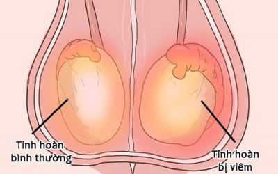 Tác dụng của tinh hoàn và những bệnh lý liên quan