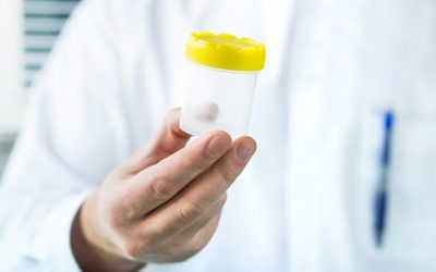 Chia sẻ kinh nghiệm xét nghiệm tinh trùng ở đại học y Hà Nội từ A-Z