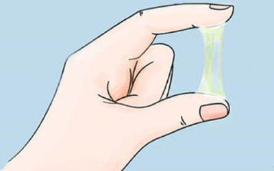 Nguyên nhân khí hư đặc dính như hồ và cách điều trị