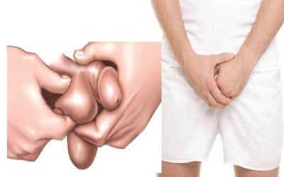 Danh sách 7 loại thuốc bôi đặc trị ngứa bìu phổ biến hiện nay