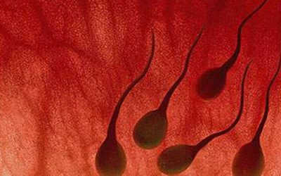 Tinh trùng có màu đỏ hồng cảnh báo ung thư tinh hoàn