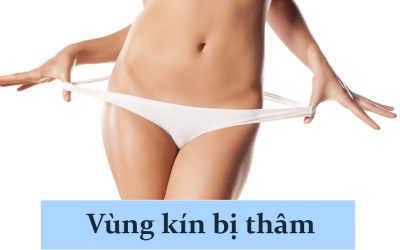 Tại sao vùng kín bị thâm? Làm gì để khắc phục tình trạng này?