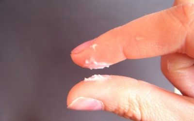 Bựa sinh dục là như thế nào? Làm sao để hết bựa sinh dục?